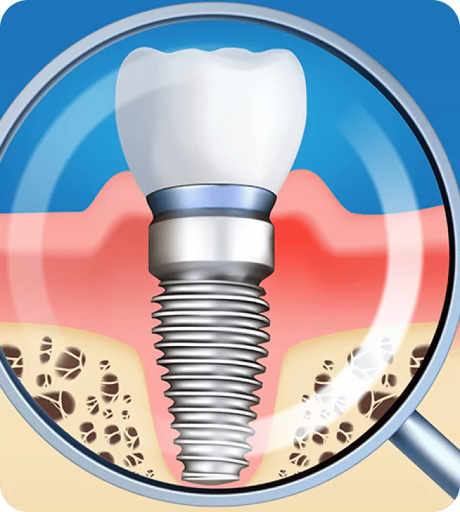 Hands-on Implant Restorative